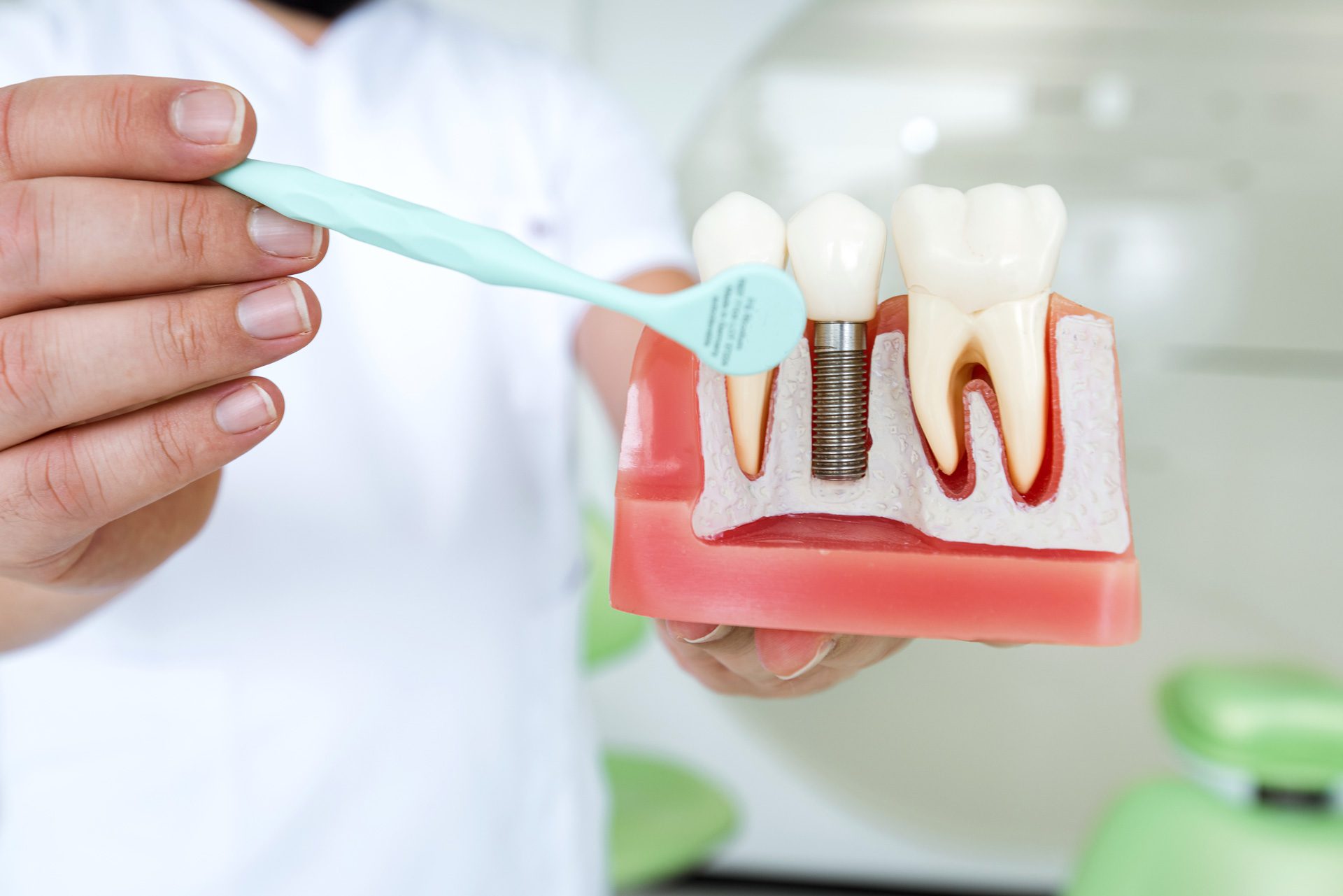 Do You Have Missing Teeth? What Are Your Solutions?