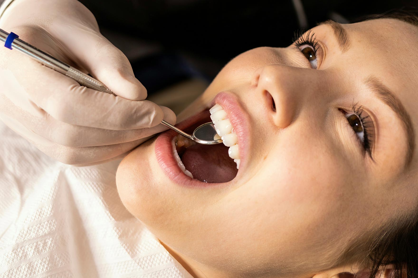 Why Regular Dental Check-Ups and Hygiene Visits Matter
